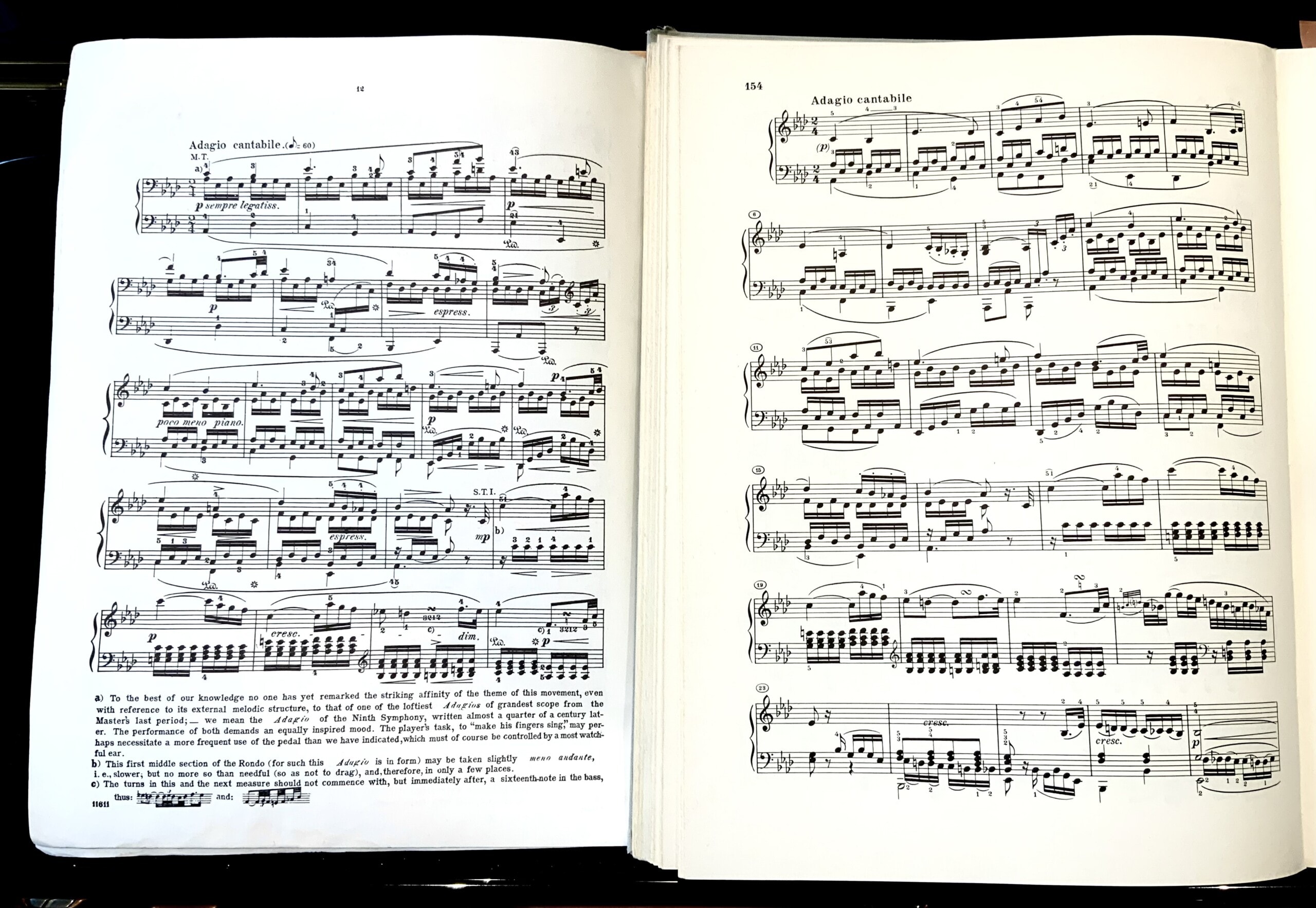 Beethoven Sonata Op. 13 comparisons